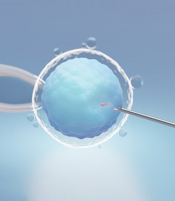 Intracytoplasmic Sperm Injection(ICSI)
